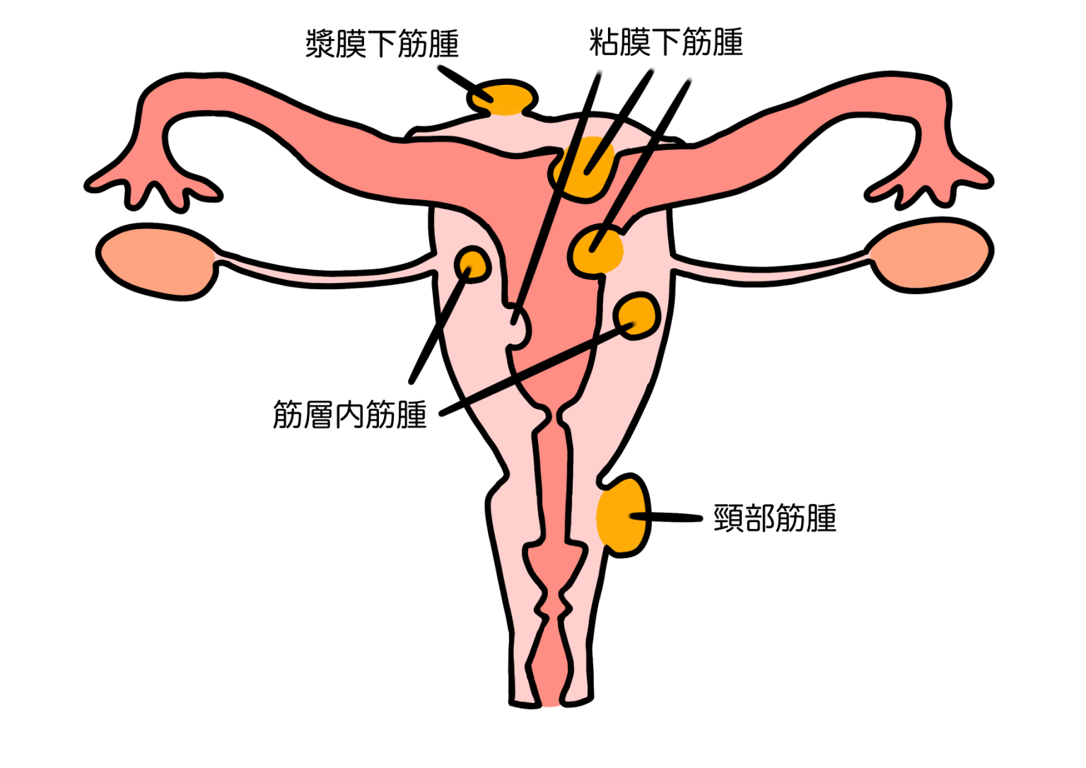 なぜ白いドレスのシンボルを使うのでしょうか?