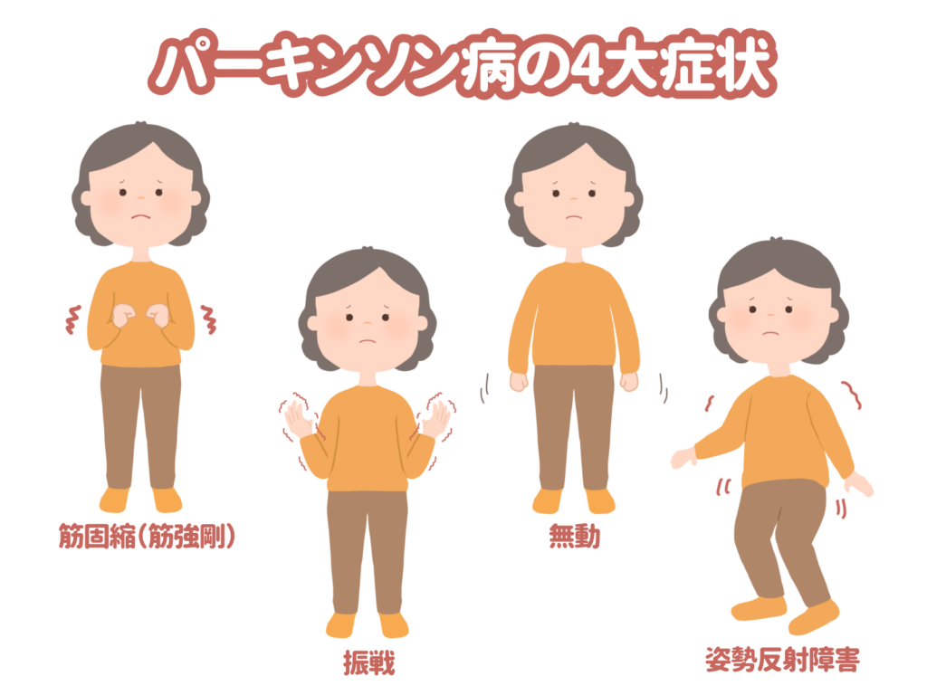 パーキンソン病
